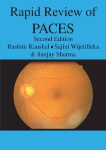 Rapid Review of PACES 2nd Revised Edition