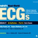 Podrid’s Real-World ECGs A Master’s Approach to the Art and Practice of Clinical ECG Interpretation. Volume 4A, Arrhythmias Core Cases 1st Edition PDF Download