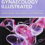 Download Gynaecology Illustrated 6th Edition PDF Free