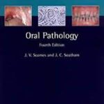 Oral Pathology by Soames 4th Edition PDF