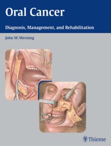 Oral Cancer: Diagnosis Management and Rehabilitation 1st Edition