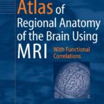 Download Atlas of Regional Anatomy of the Brain Using MRI With Functional Correlations 2nd Edition PDF Free