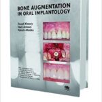 Download Bone Augmentation in Oral Implantology by Fouad Khoury PDF Free