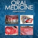 Download Burket’s Oral Medicine 11th Edition PDF Free