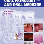 Download Cawson’s Essentials of Oral Pathology and Oral Medicine 8th Edition PDF Free