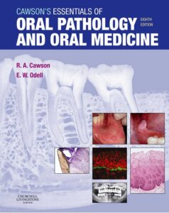 Cawson's Essentials of Oral Pathology and Oral Medicine 8th Edition