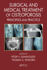 Surgical and Medical Treatment of Osteoporosis: Principles and Practice 1st Edition