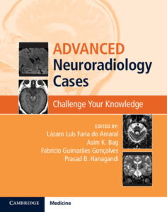 Advanced Neuroradiology Cases Challenge Your Knowledge First Edition