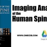 Download Imaging Anatomy Human Spine PDF Free Download