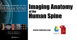 Download Imaging Anatomy Human Spine