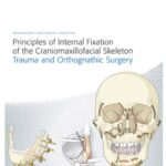 Principles of Internal Fixation of the Craniomaxillofacial Skeleton Trauma and Orthognathic Surgery 1st Edition PDF Download