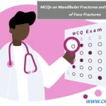 MCQs on Mandibular Fractures and Middle Third of Face Fractures (Test Version)